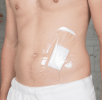 SEAL-TIGHT Shield (Pk/5) Dressing & Wound Protector
