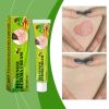South Moon Bee Venom Skin Repair Cream, Relieve Skin Itching, Redness And Moisturize Skin Body Care Cream