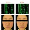Led Face Mask light therapy led mask Red Light IR photon skin rejuvenation - Made in KOREA