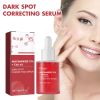 Hoygi Dark Spots Repair Essence, Moisturizing And Brightening Repair Essence For Dark Spots And Age Spots
