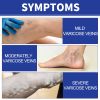 Ximonth Vein Comfort Spray, Relief Leg Muscle Soreness And Swelling Earthworm Leg Vein Treatment Spray